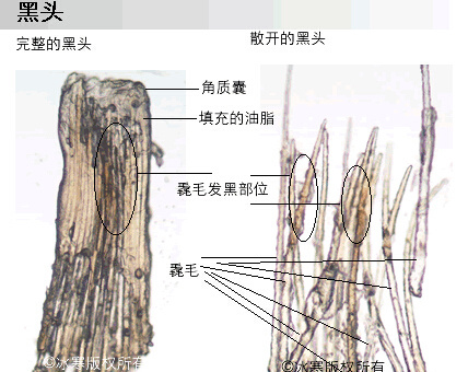 夏季男士如何摆脱毛孔粗大