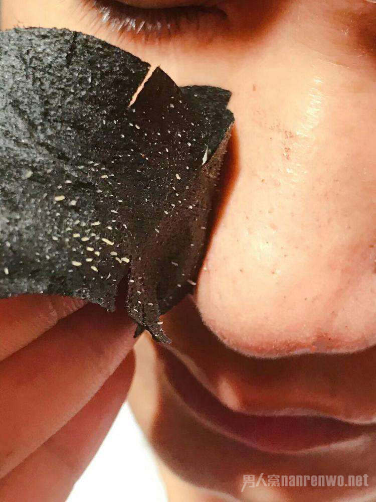 男士如何去黑头 选对方法让你彻底摆脱草莓鼻