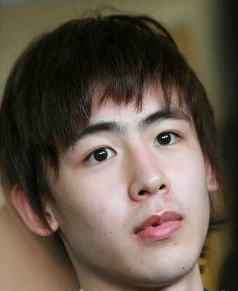 男生唇边长痘痘是什么原因 唇边痘诱因大找茬